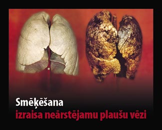 Latvia 2010 Health Effects lung - diseased organ, lung cancer, gross